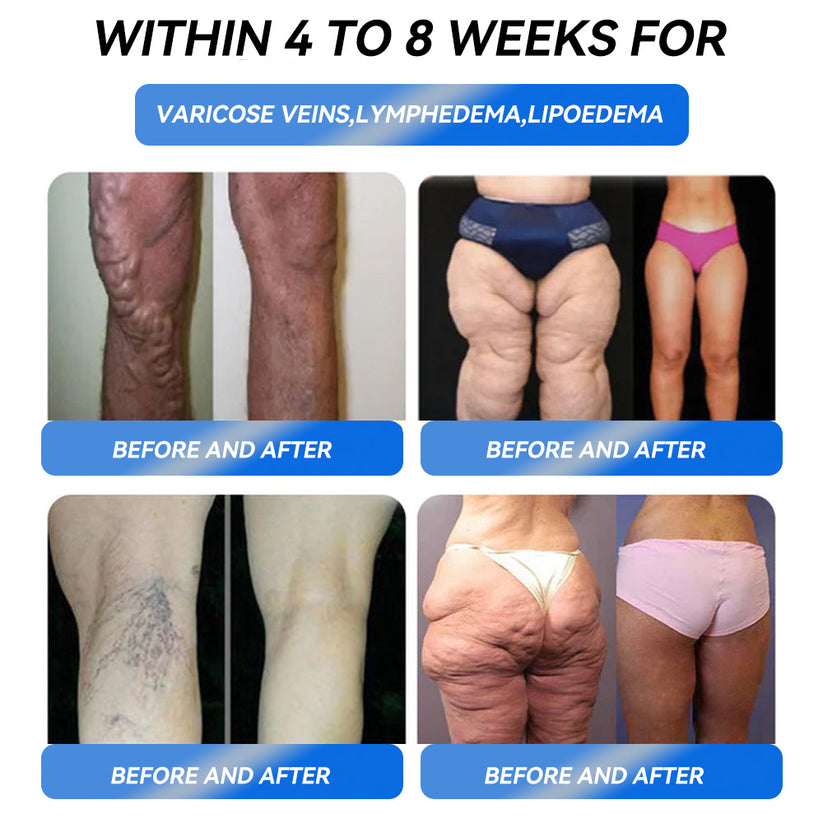 HONXI® GLP-1 Pro Weight Loss Oral Solution ✅One dose a day — see results in 7 days👩⚕️Suitable for obesity, cardiovascular diseases, diabetes, sleep apnea, high cholesterol and blood lipids, joint problems, and various other conditions🚀