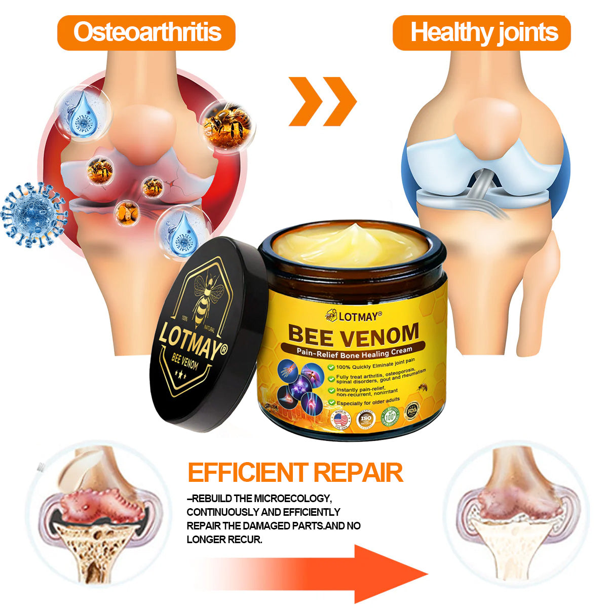 LOTMAY® Bee Venom Pain-Relief Bone Healing Cream 🐝🐝(Recommended by the American Academy of Orthopaedic Surgeons (AAOS))