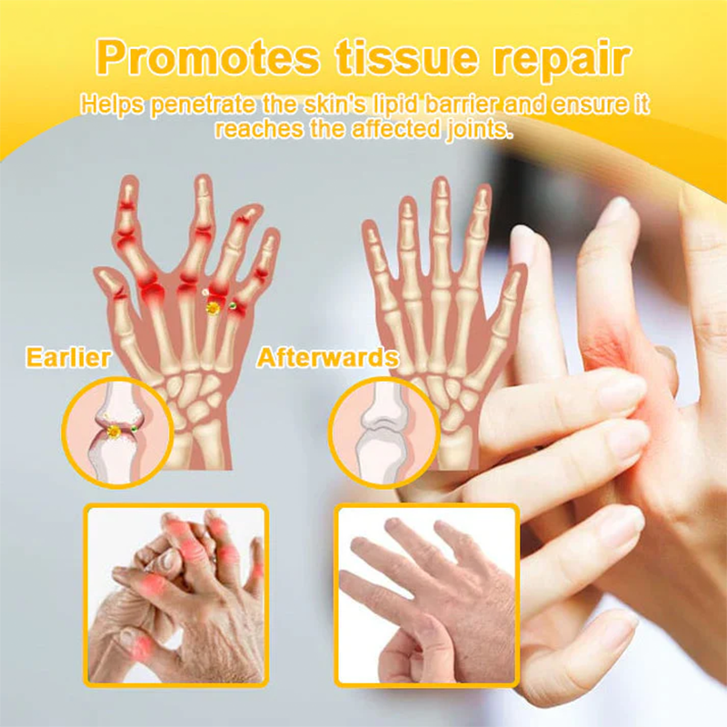 LOTMAY® Joint Freedom Formula Cream – 9-in-1 Natural Formula (FDA-Certified & Recommended)