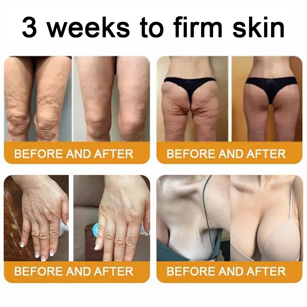 LOTMAY® Your Favorite Skin Secret – Now 80% OFF for a Limited Time! 💛