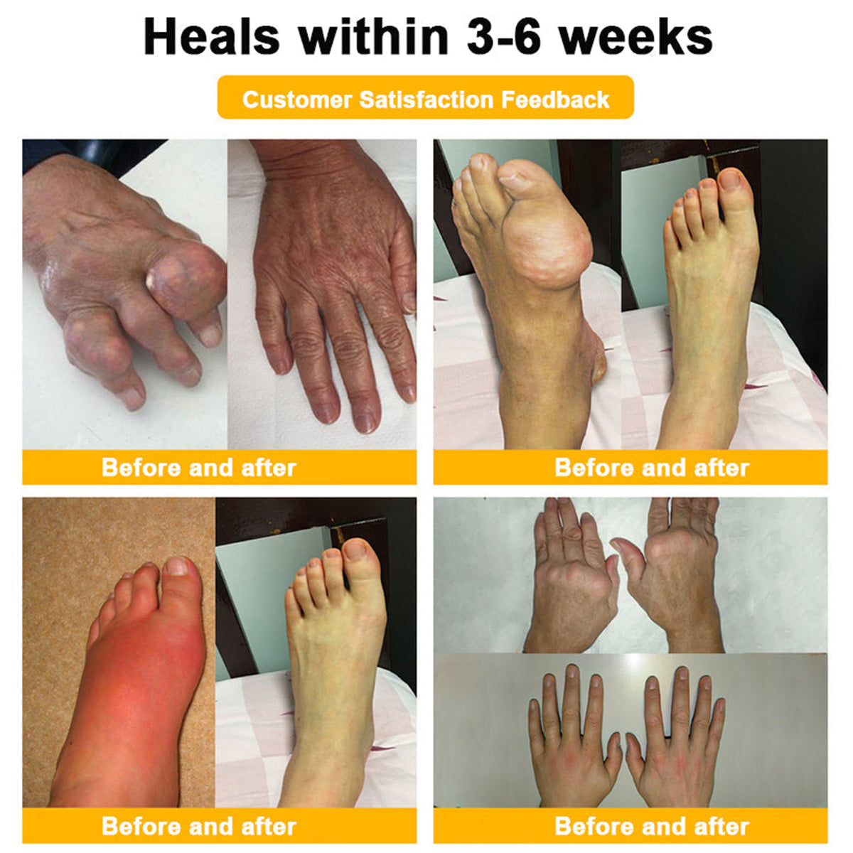 LOTMAY® Bee Venom Pain-Relief Bone Healing Cream 🐝🐝(Recommended by the American Academy of Orthopaedic Surgeons (AAOS))