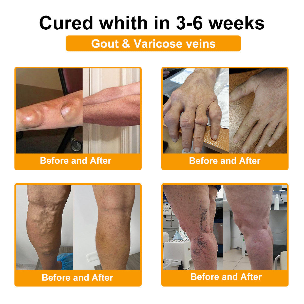 LOTMAY® Bee Venom Pain-Relief Bone Healing Cream 🐝🐝(Recommended by the American Academy of Orthopaedic Surgeons (AAOS))
