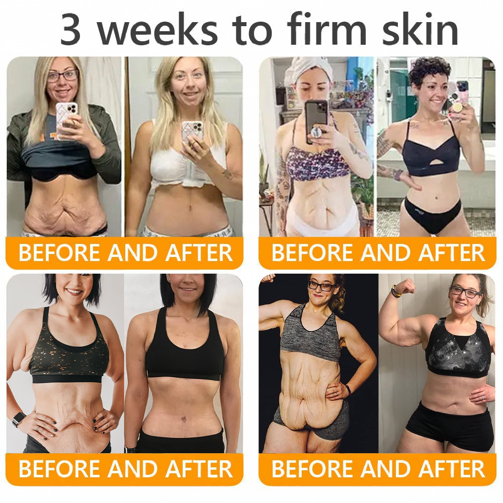 LOTMAY® Your Favorite Skin Secret – Now 80% OFF for a Limited Time! 💛