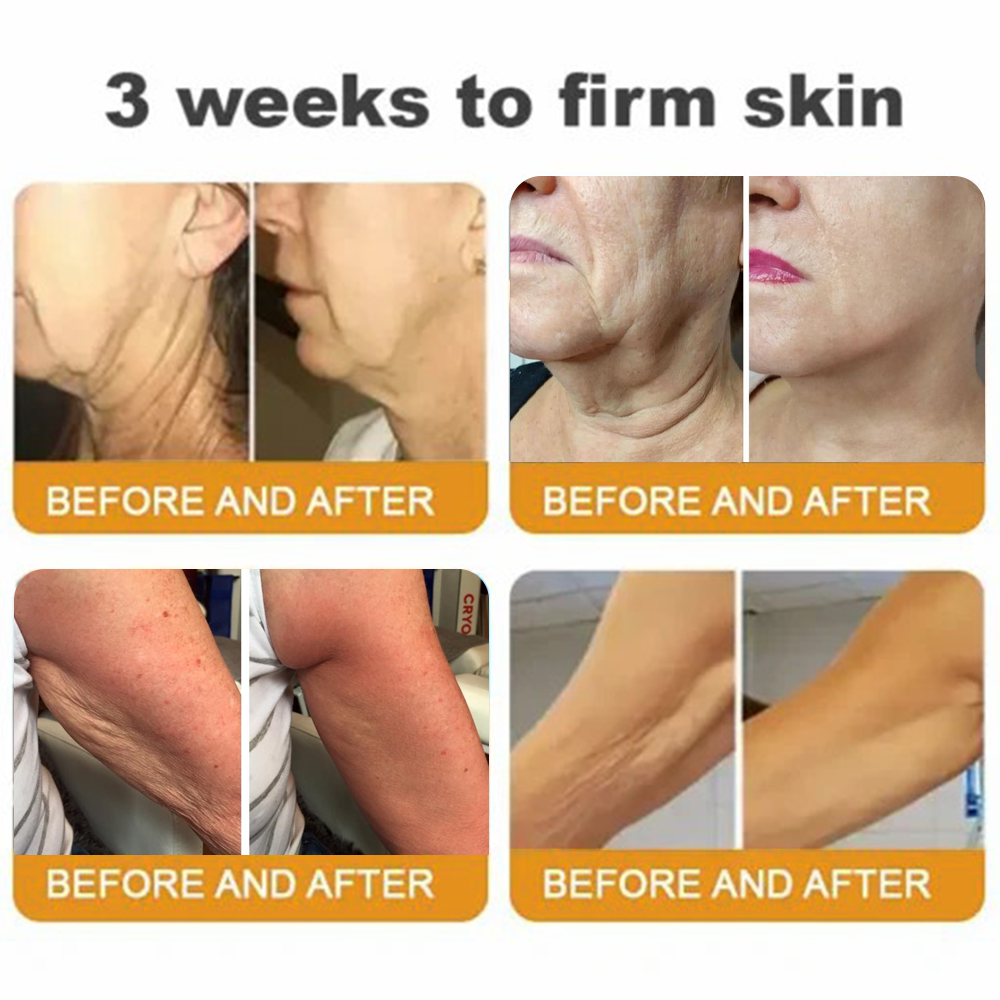 LOTMAY® Your Favorite Skin Secret – Now 80% OFF for a Limited Time! 💛