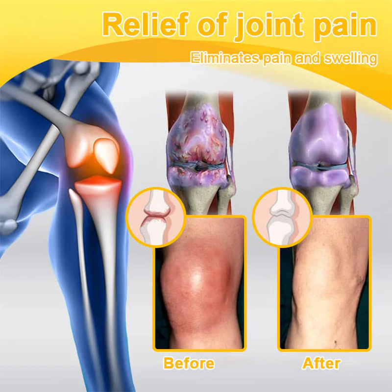 LOTMAY® Joint Freedom Formula Cream – 9-in-1 Natural Formula (FDA-Certified & Recommended)