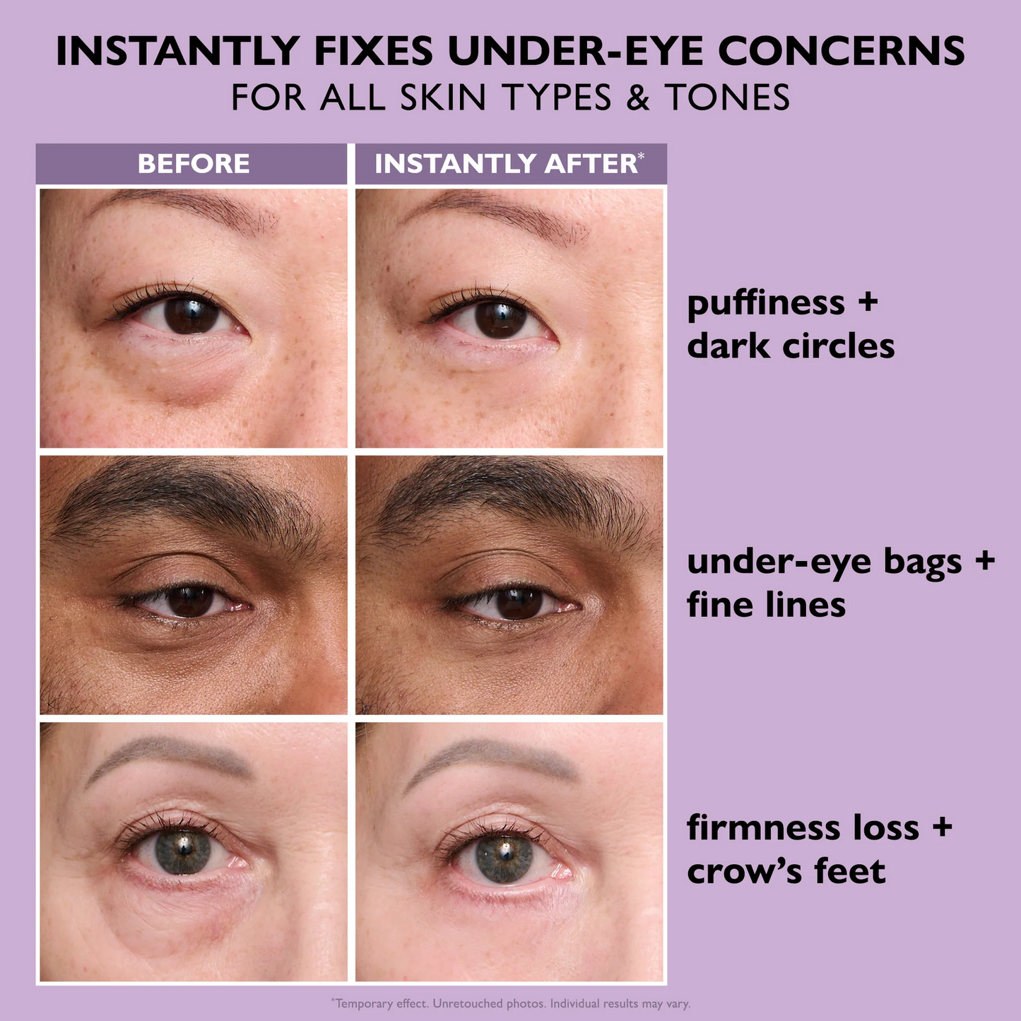 Official Store | Coolord® Instant FirmXBOTOX Easy Wear Temporary Eye Tightener with Collagen, Bee venom & Matrixyl 3000, Free brush🔥