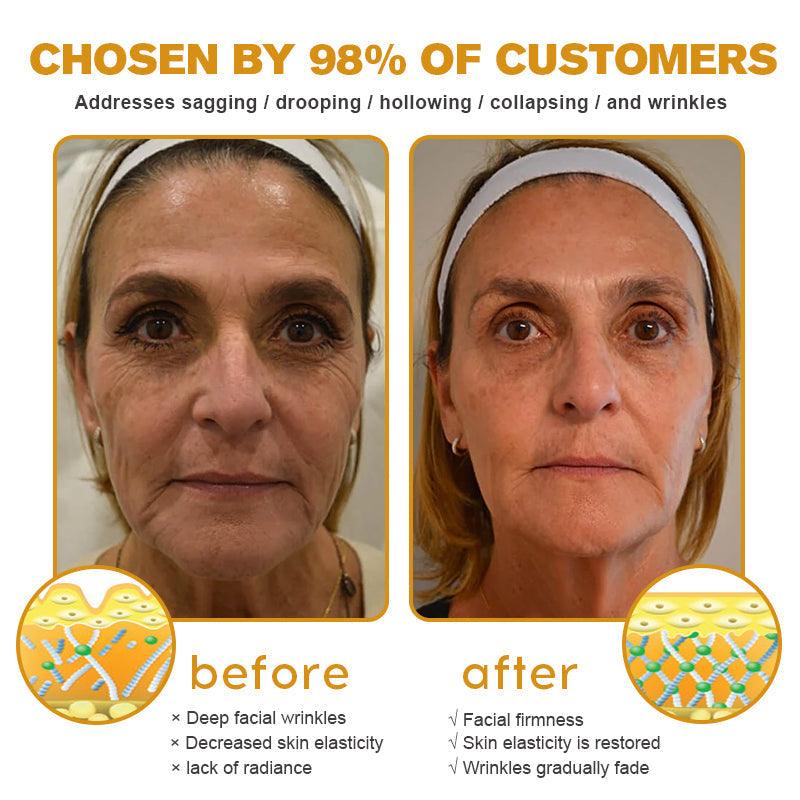 Official Store | Coolord® Instant FirmXBOTOX Easy Wear Temporary Eye Tightener with Collagen, Bee venom & Matrixyl 3000, Free brush🔥