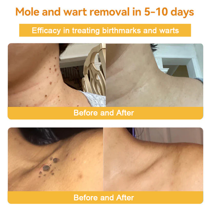 [Winter-Skincare] Raindew™ Bee Venom Skin Treatment Cream（AAD RECOMMENDED FROM US）