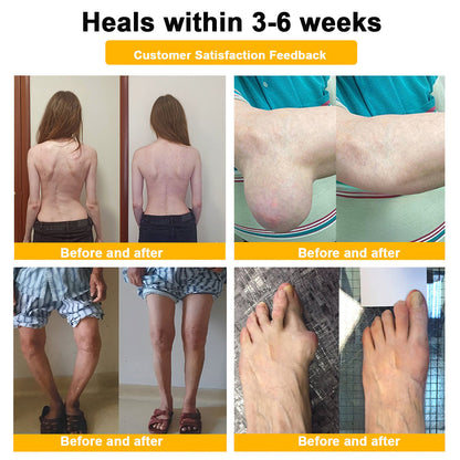 LOTMAY® Bee Venom Pain-Relief Bone Healing Cream 🐝🐝(Recommended by the American Academy of Orthopaedic Surgeons (AAOS))
