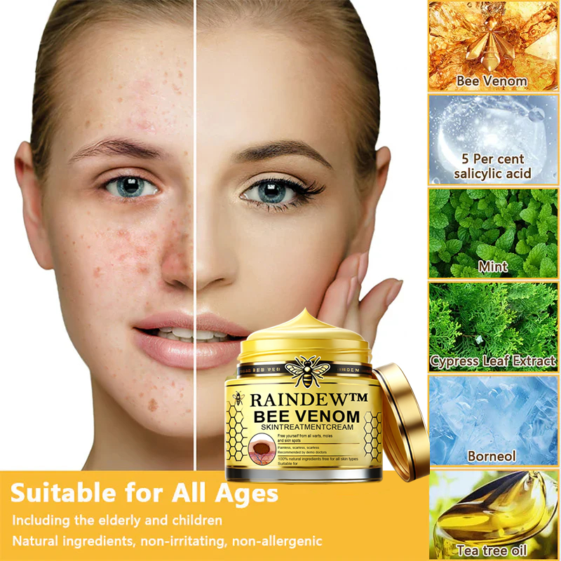 [Winter-Skincare] Raindew™ Bee Venom Skin Treatment Cream（AAD RECOMMENDED FROM US）