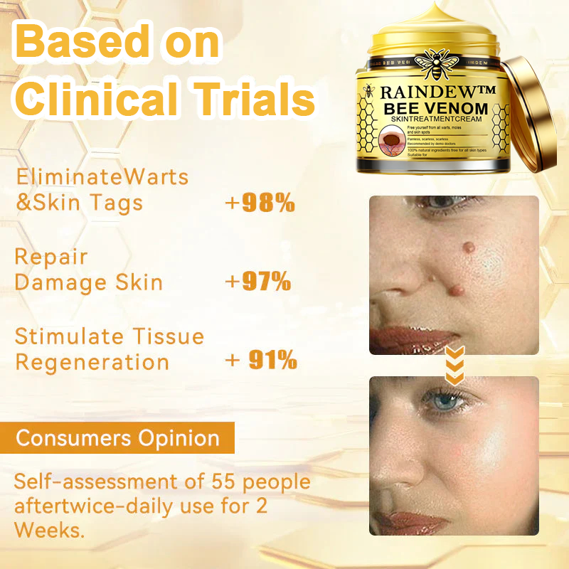 [Winter-Skincare] Raindew™ Bee Venom Skin Treatment Cream（AAD RECOMMENDED FROM US）