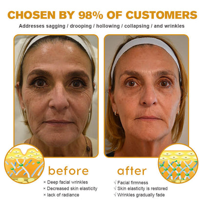 Official Store | Coolord® Instant FirmXBOTOX Easy Wear Temporary Eye Tightener with Collagen, Bee venom & Matrixyl 3000, Free brush🔥